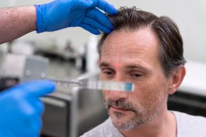 Traitement anti-chute de cheveux par mésothérapie: revitaliser le cuir chevelu pour stimuler la repousse - Dr Meulebrouck - Cabinet de médecine esthétique du grand Amiens