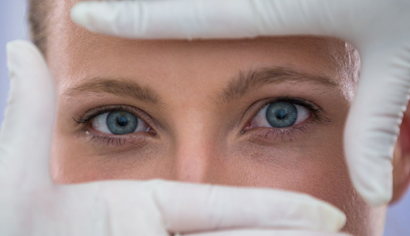 Vaisseaux périorbitaires : efficacité du laser vasculaire - Dr Meulebrouck Cabinet esthétique Amiens